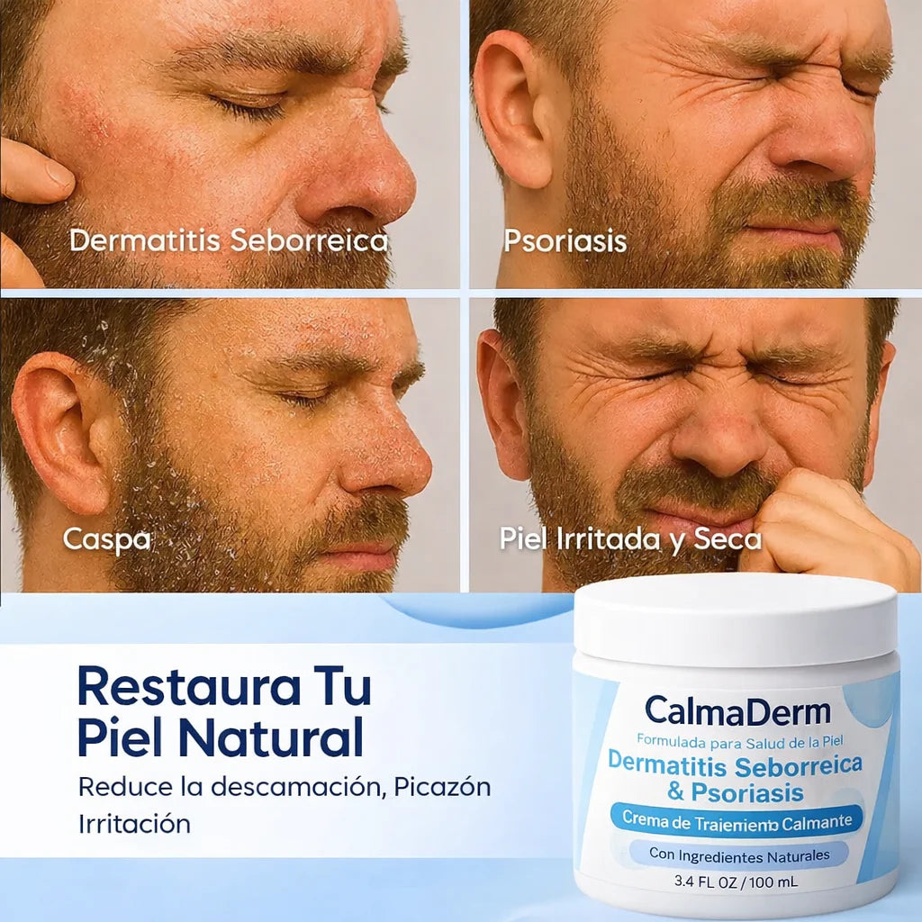 Crema Calmante: Alivio Rapido para la Picazón, Enrojecimiento y Descamación